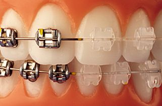Clínica Dental La Seu maquinaria para ortodoncia